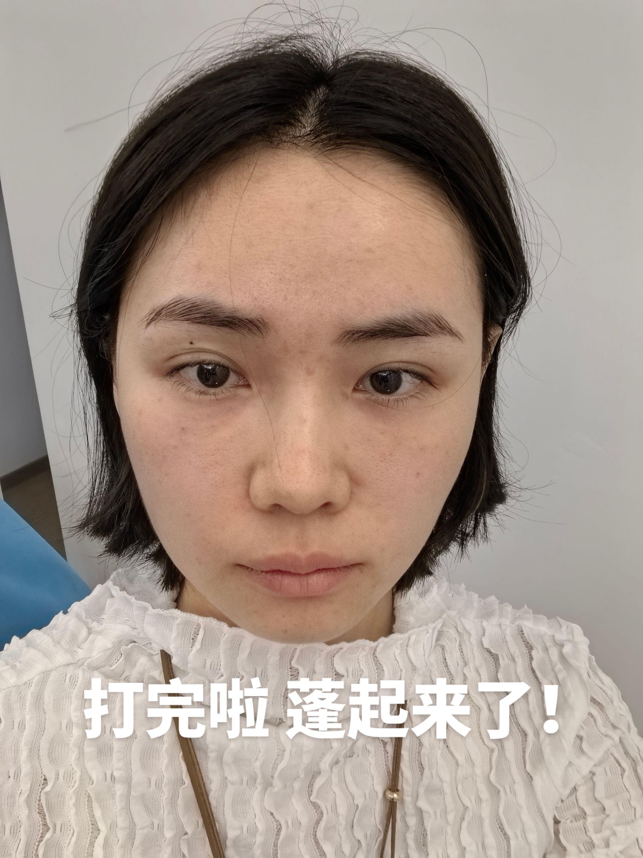 泪沟 2