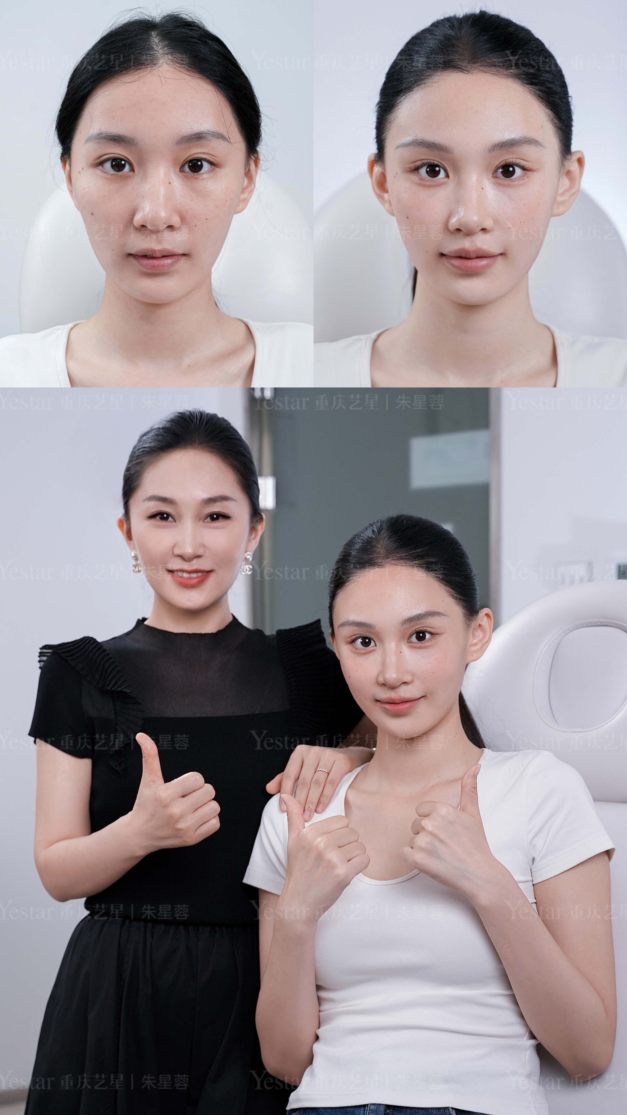 眼型视觉放大 2 倍 2