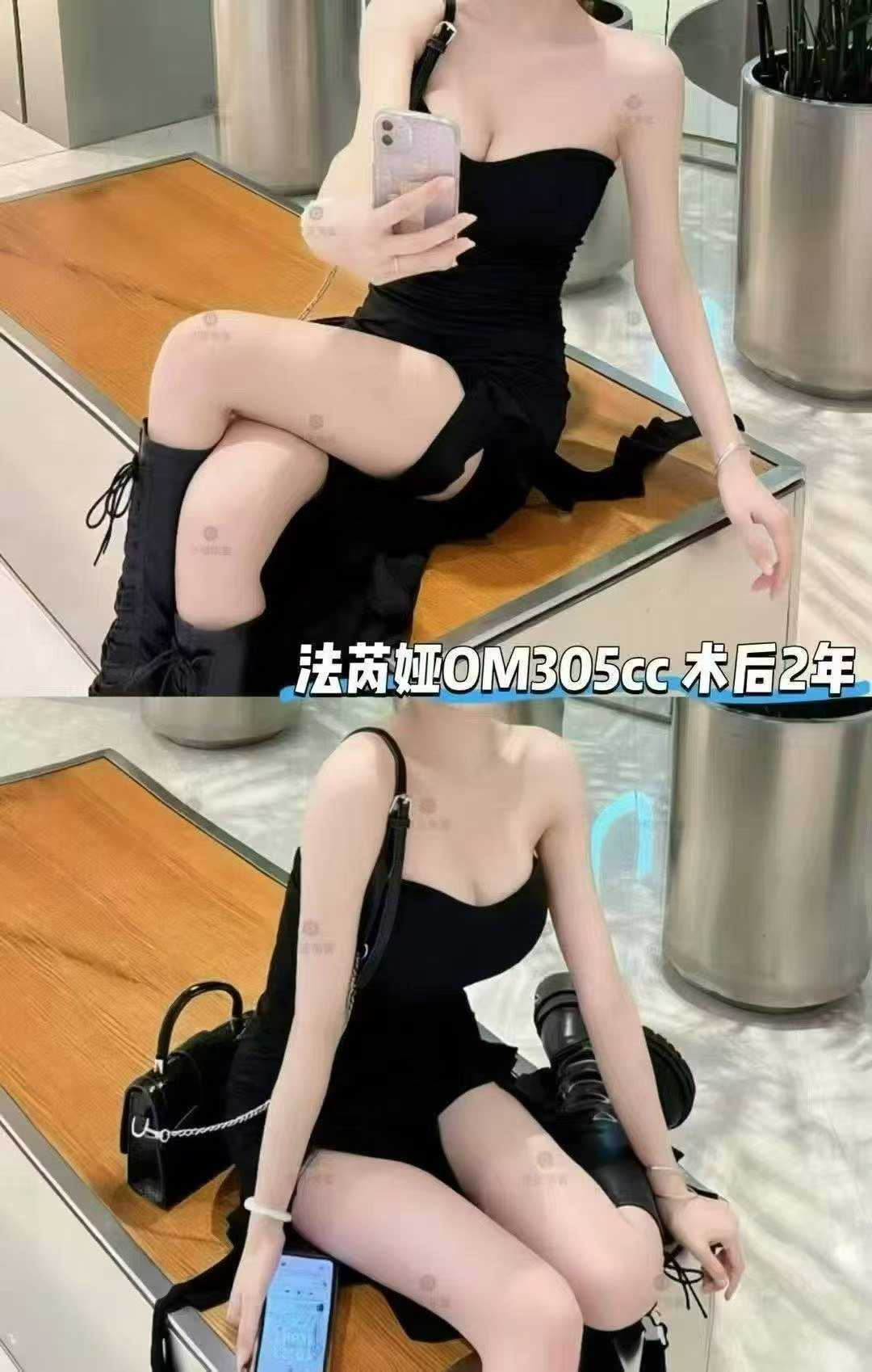 法芮娅OM305cc 1