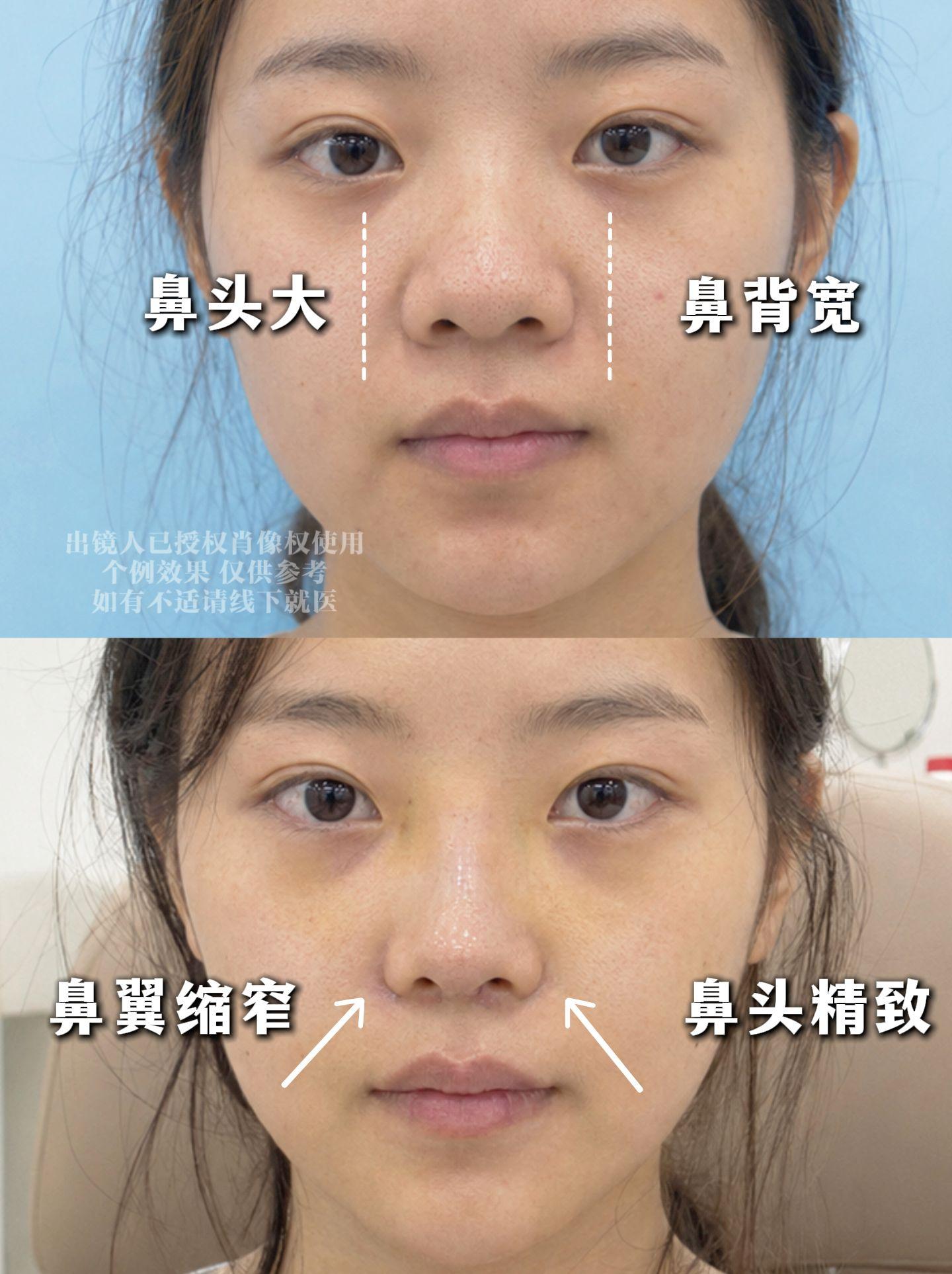 只是做了个生态鼻… 2