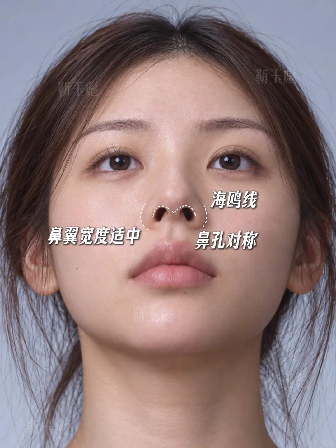 北京鼻子丨直鼻微翘 2