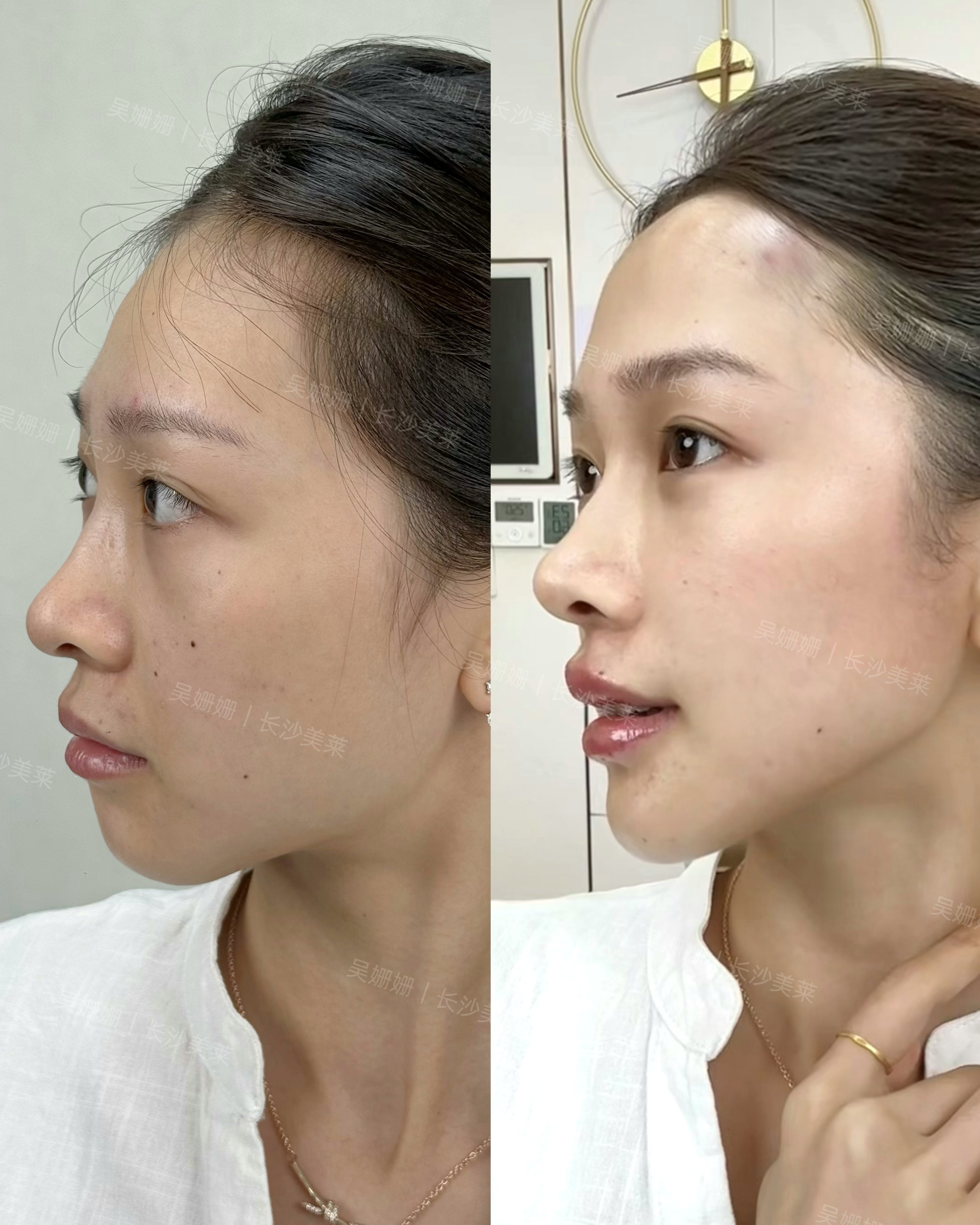 额头才是骨相美女高级感的来源！ 3