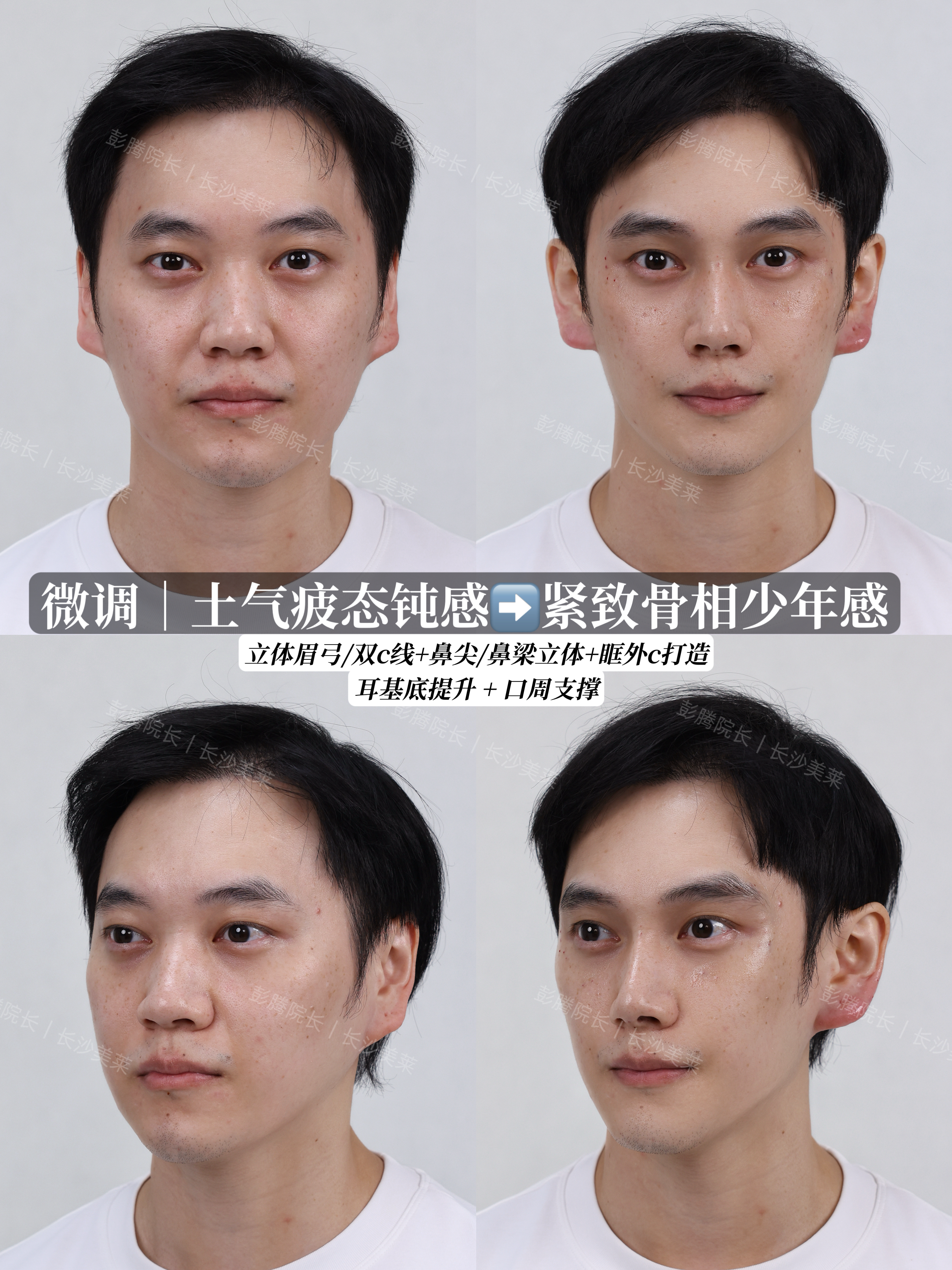 男生骨相微调 1