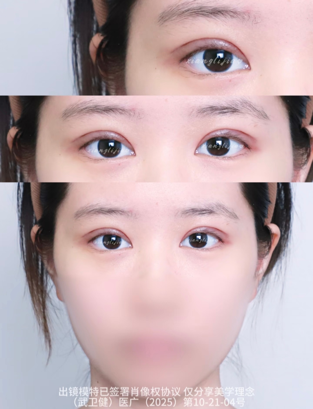 谁懂极致素颜美~ 1