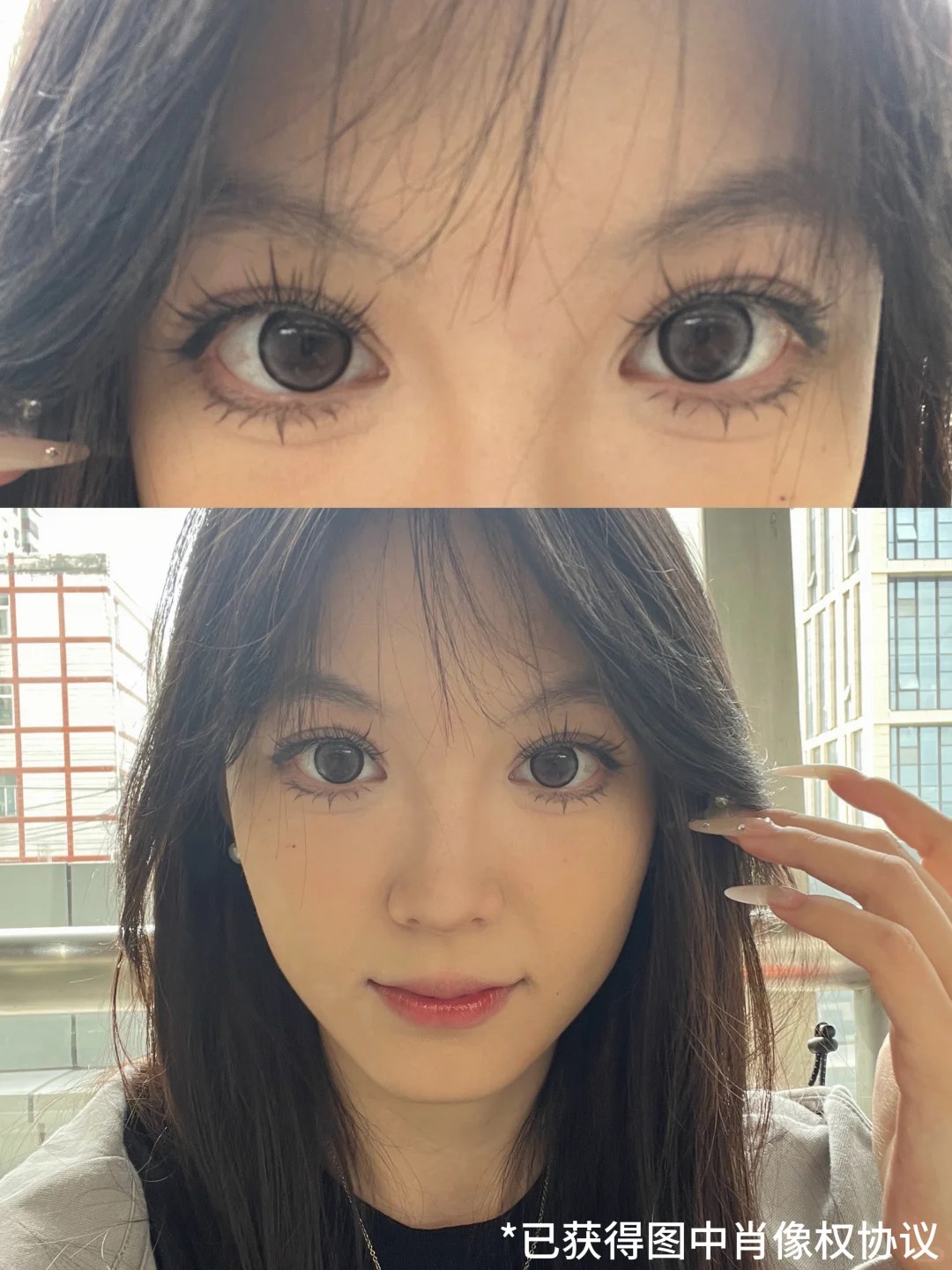 北京双眼皮！放大👁更有神