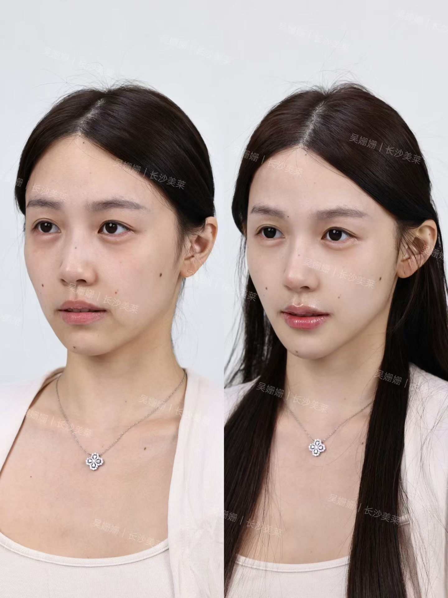 疲态菱形脸爆改温婉气质脸✨ 3