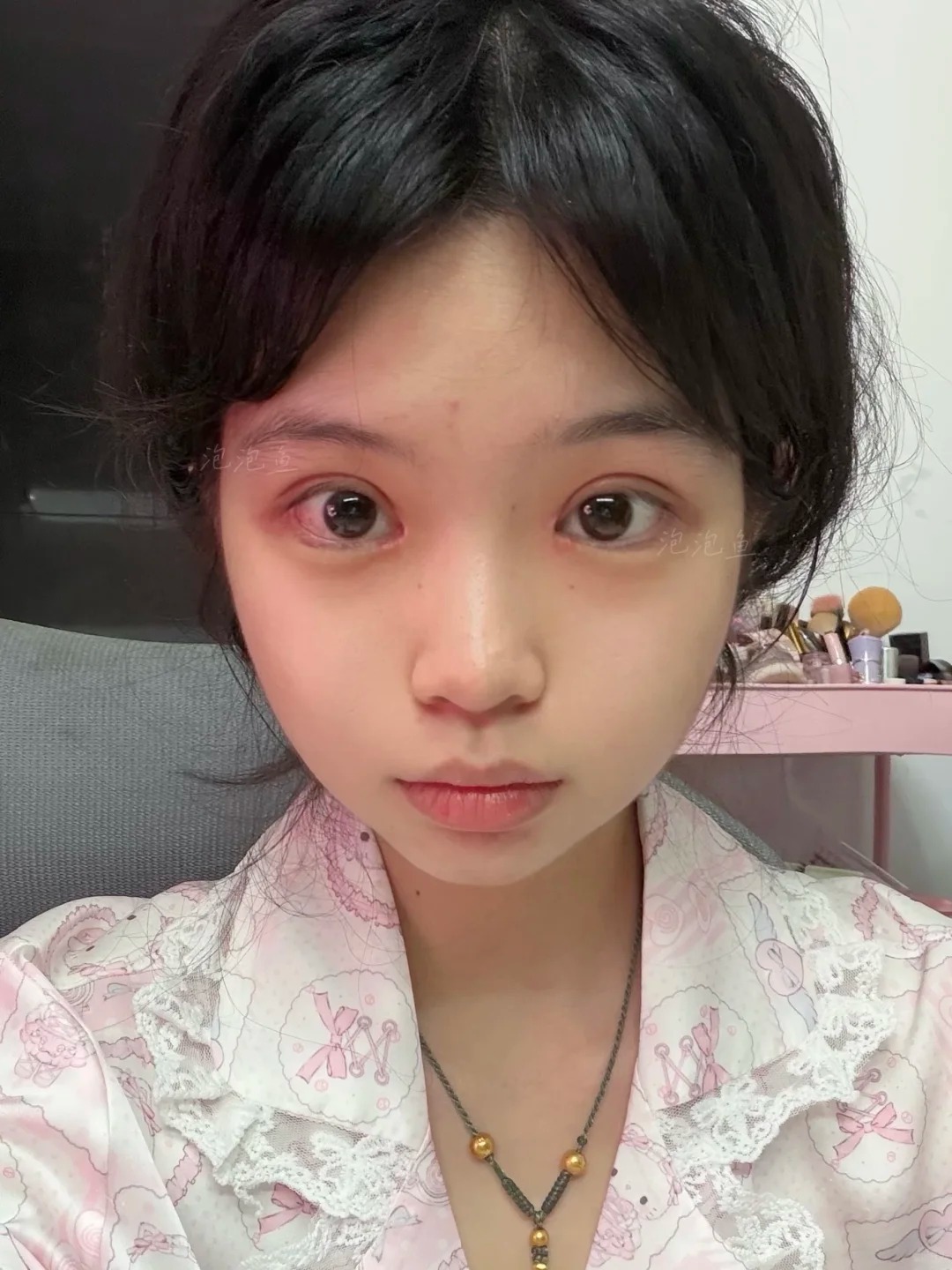 噶双眼皮大成功!!