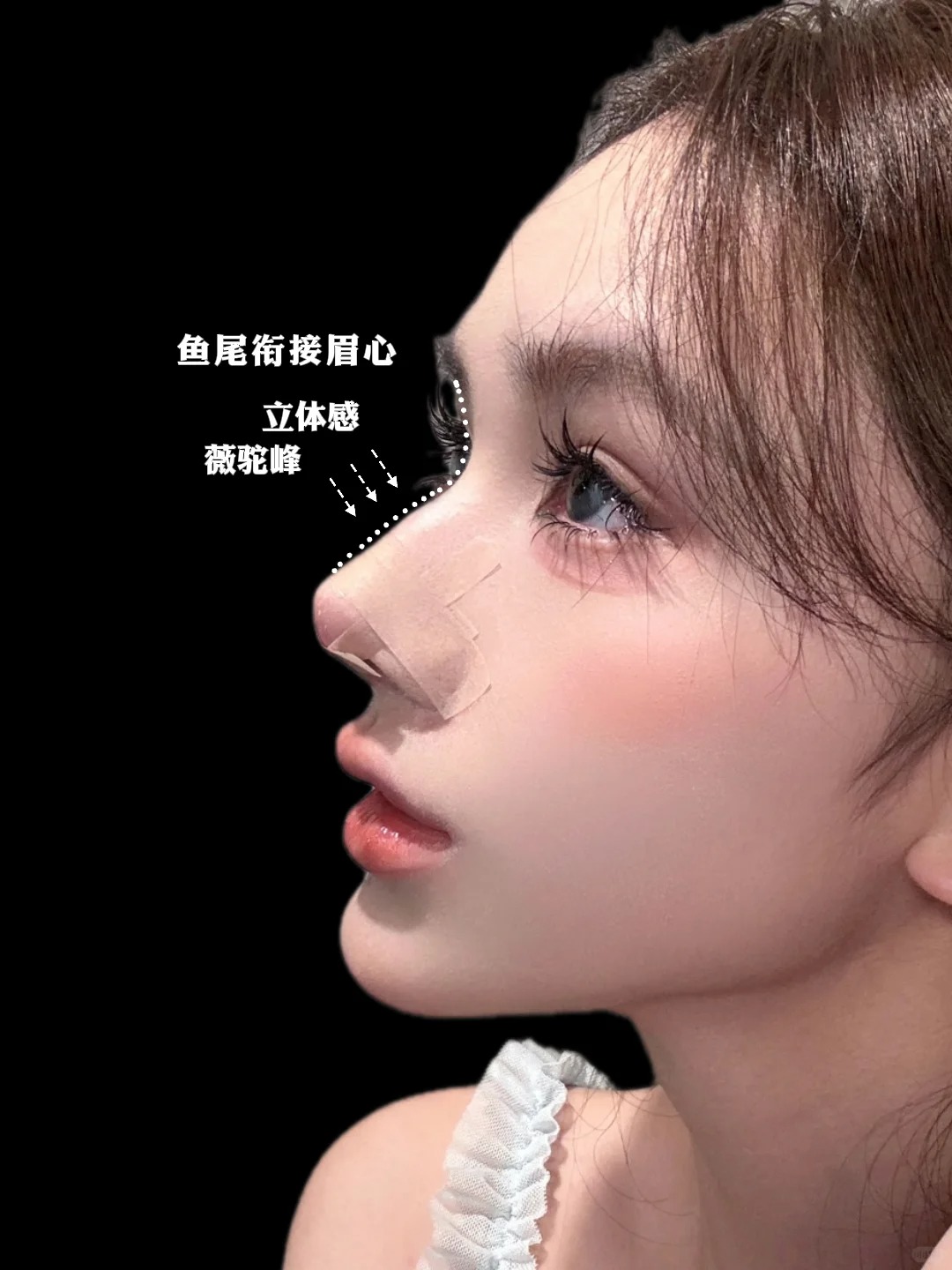 微驼峰鼻+妈生感 1