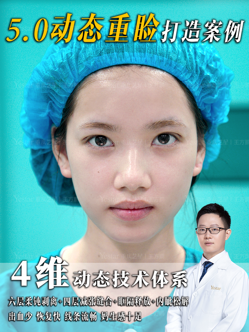 5.0动态重睑打造案例 1