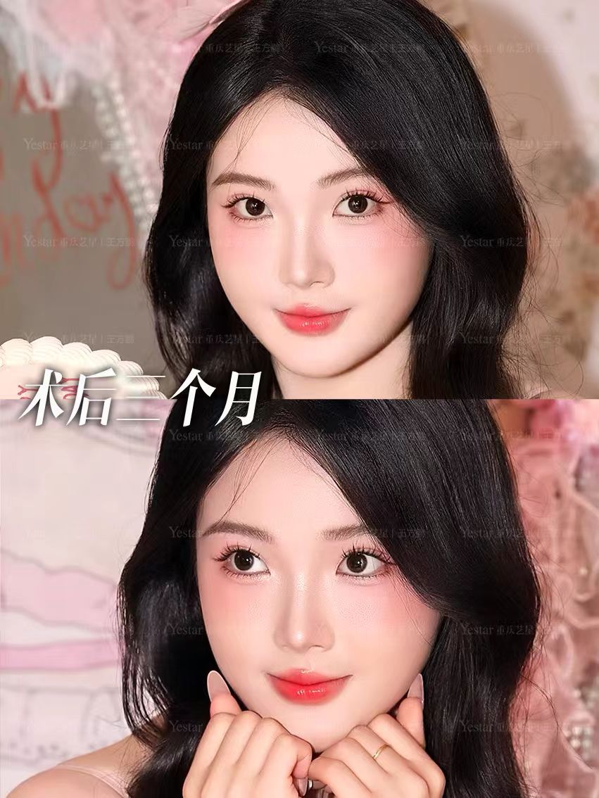 5.0动态重睑打造 1
