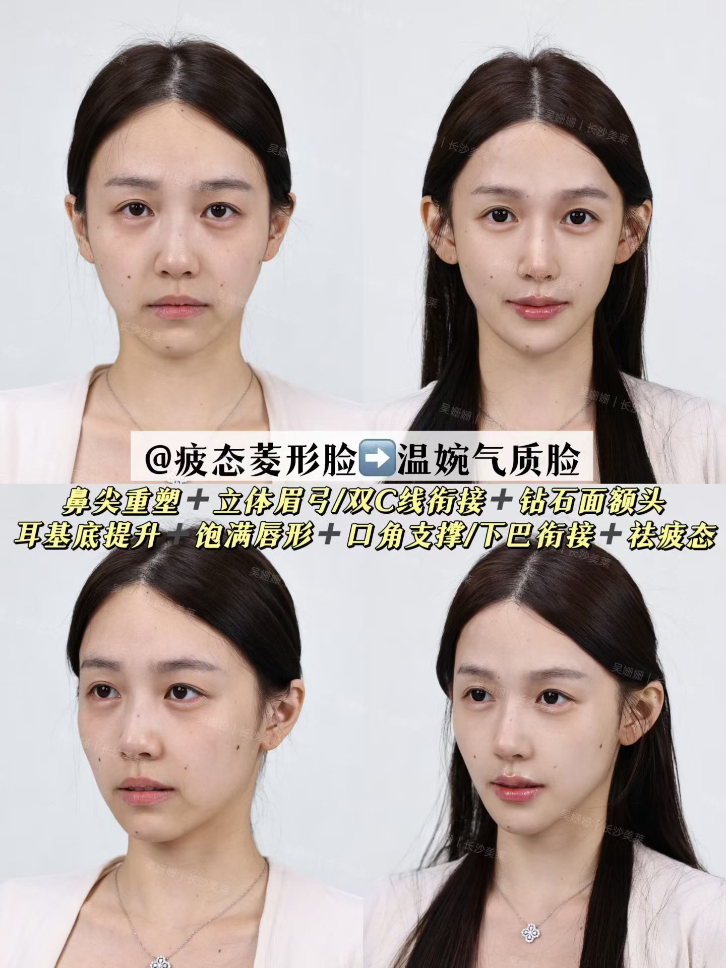 疲态菱形脸爆改温婉气质脸✨ 1