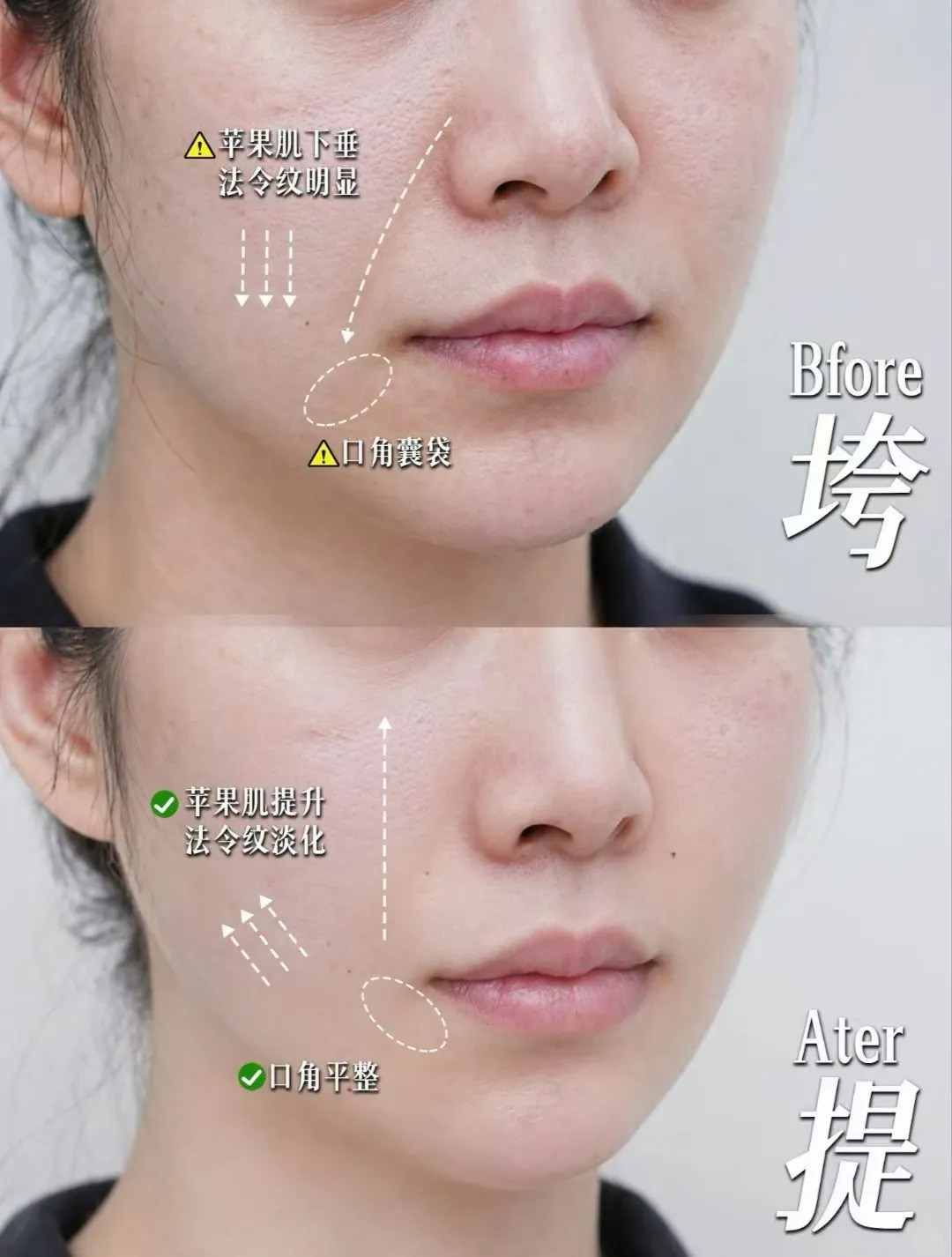 及时抗衰的重要性
