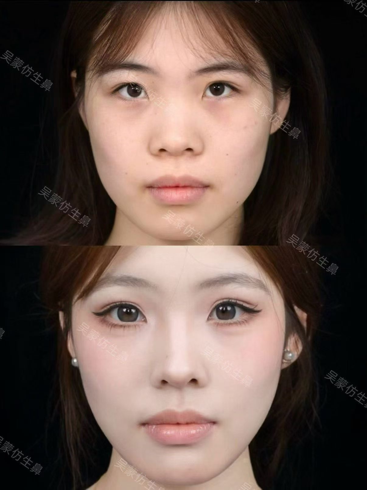 精致自然妈生鼻 1
