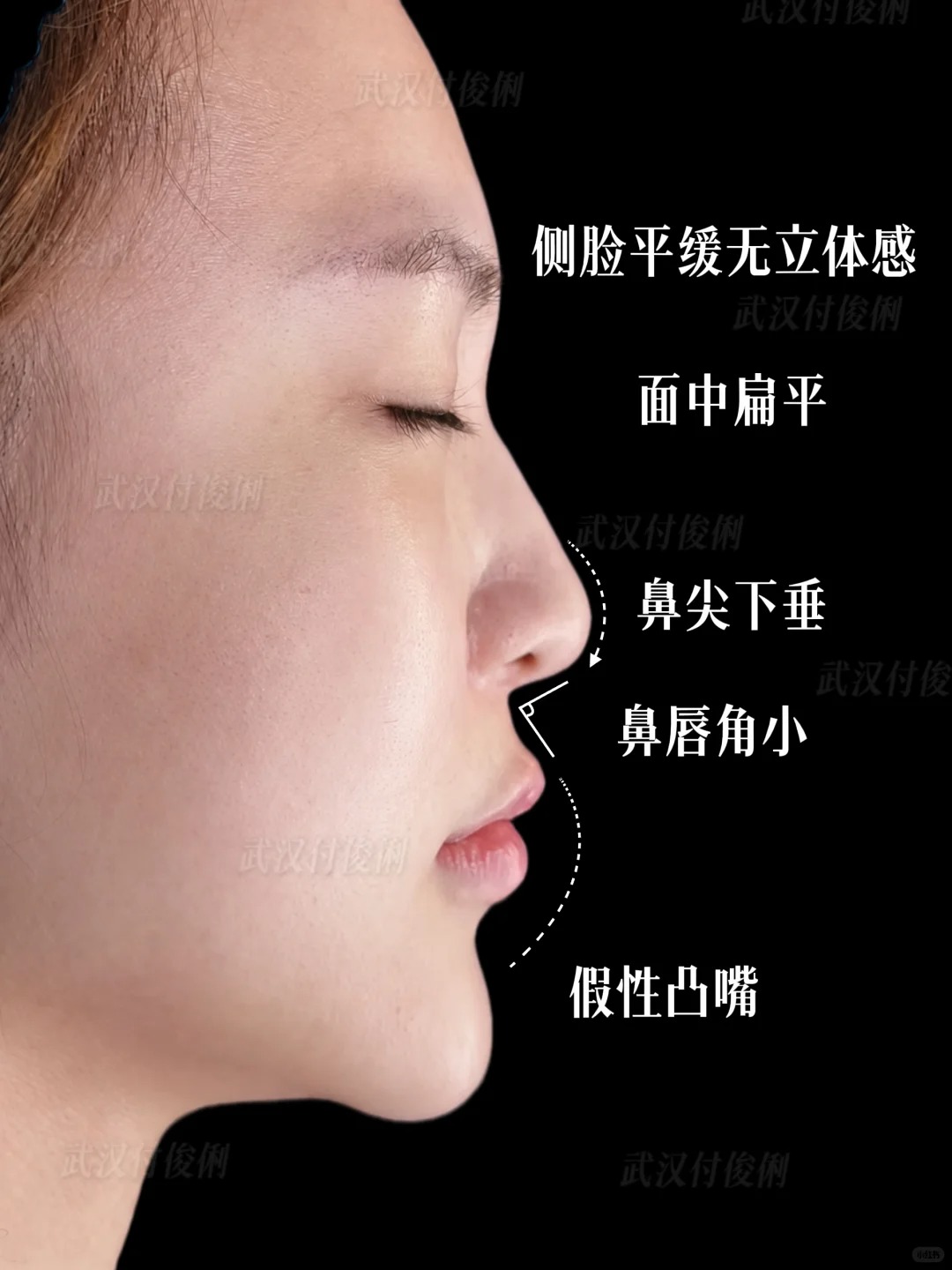 气质一下子提升了！ 2