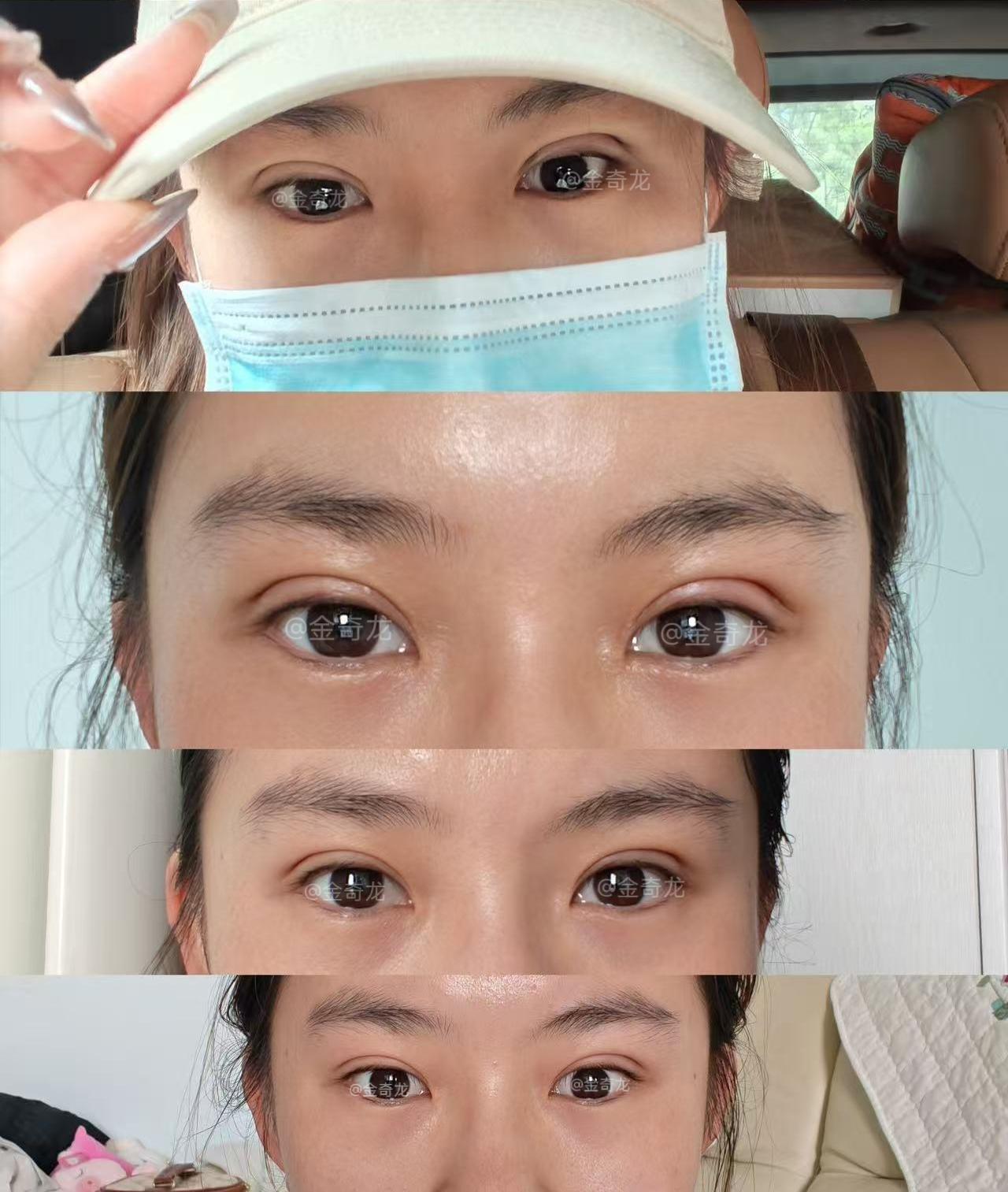 分享一组👀。你们猜多少天？ 1