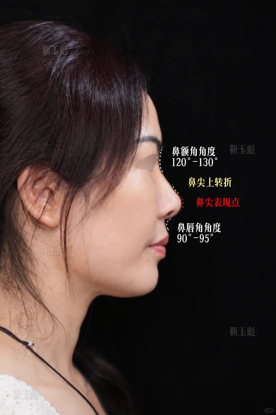 直鼻微翘 2