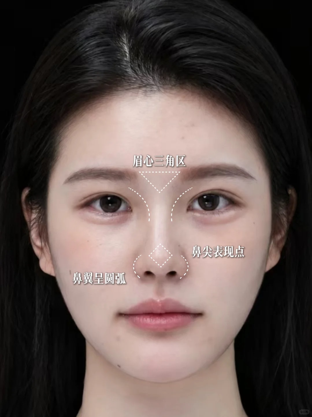 微驼峰鼻看得见的美～ 2