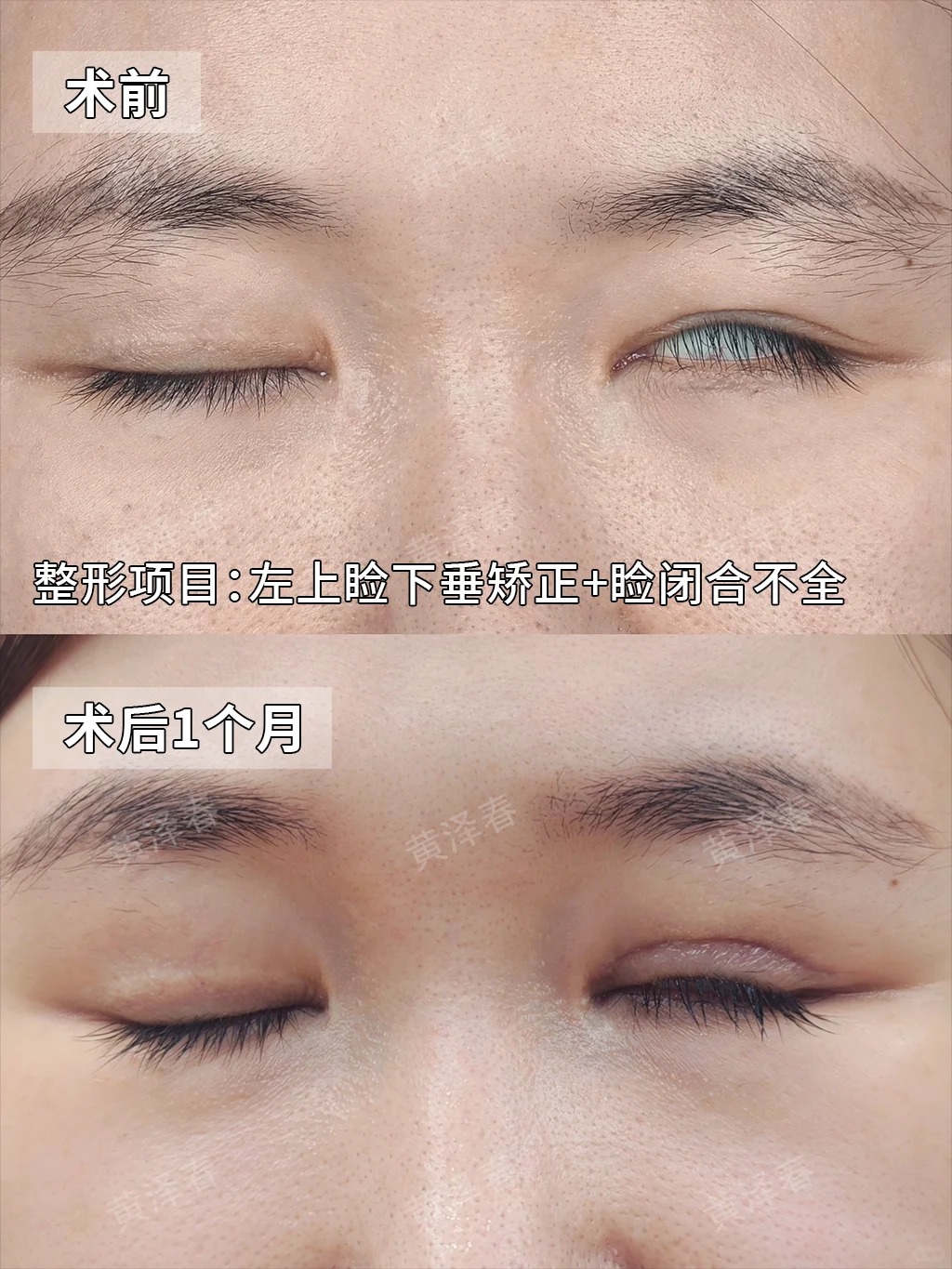 高难度眼修复 1
