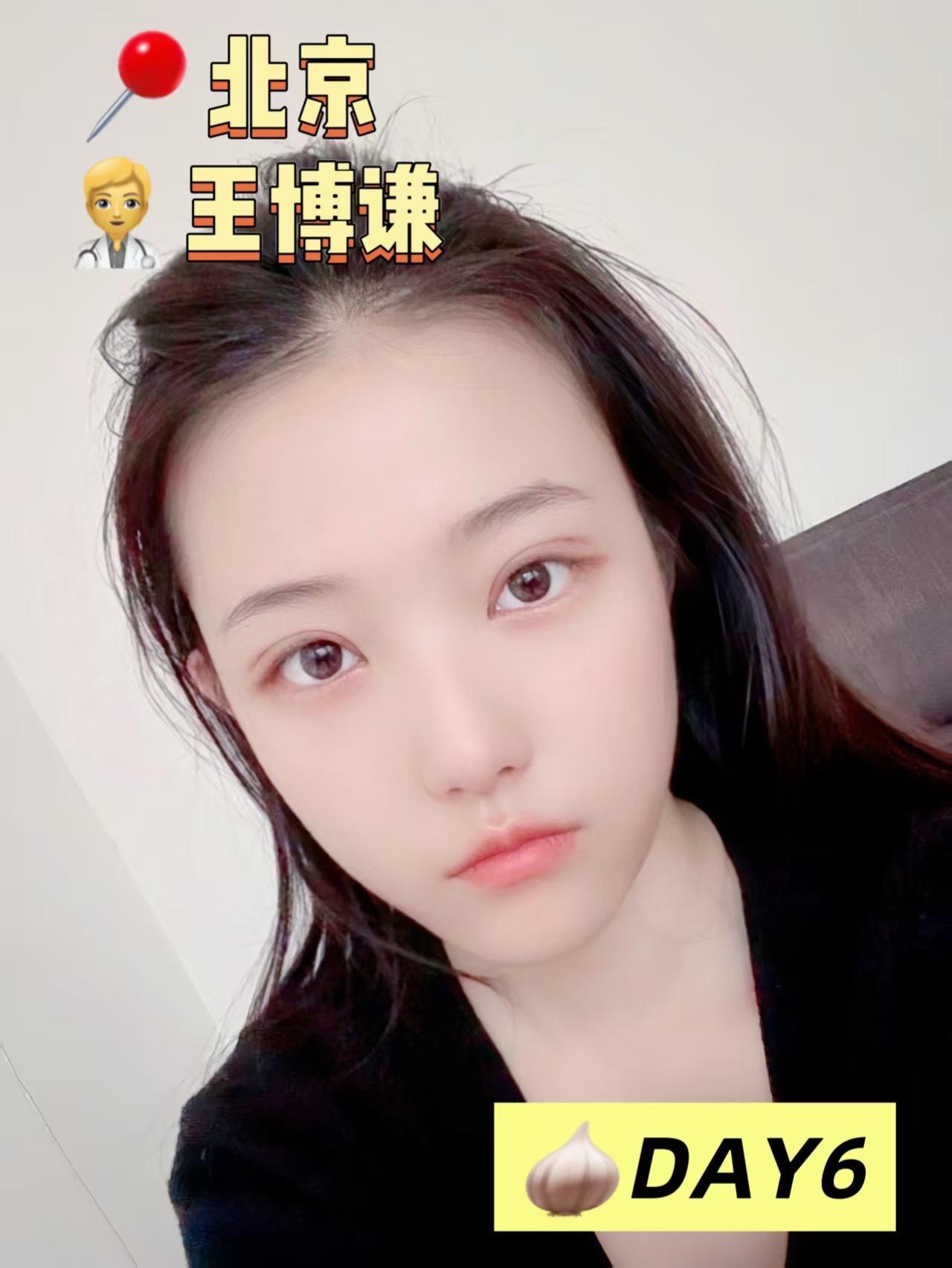 分享我的蒜皮经验 2