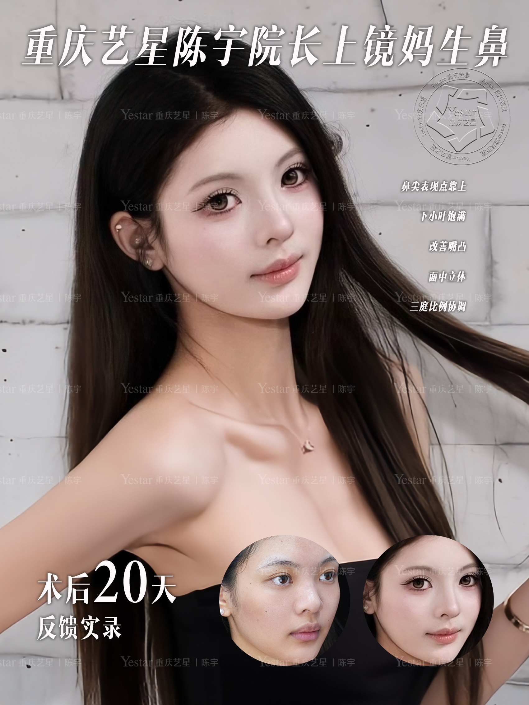 术后20天，越看越耐看💗 2