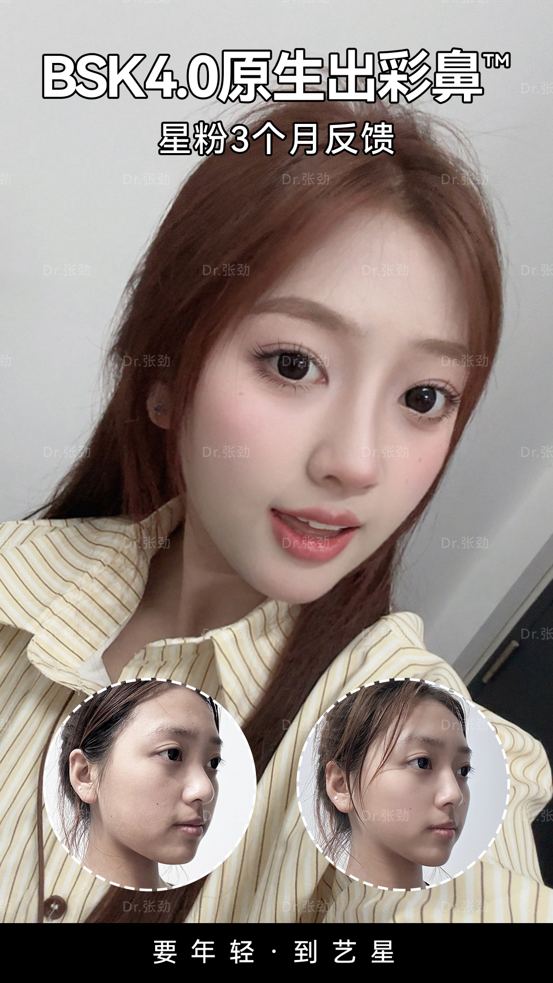 术后3个月恢复反馈✨ 1