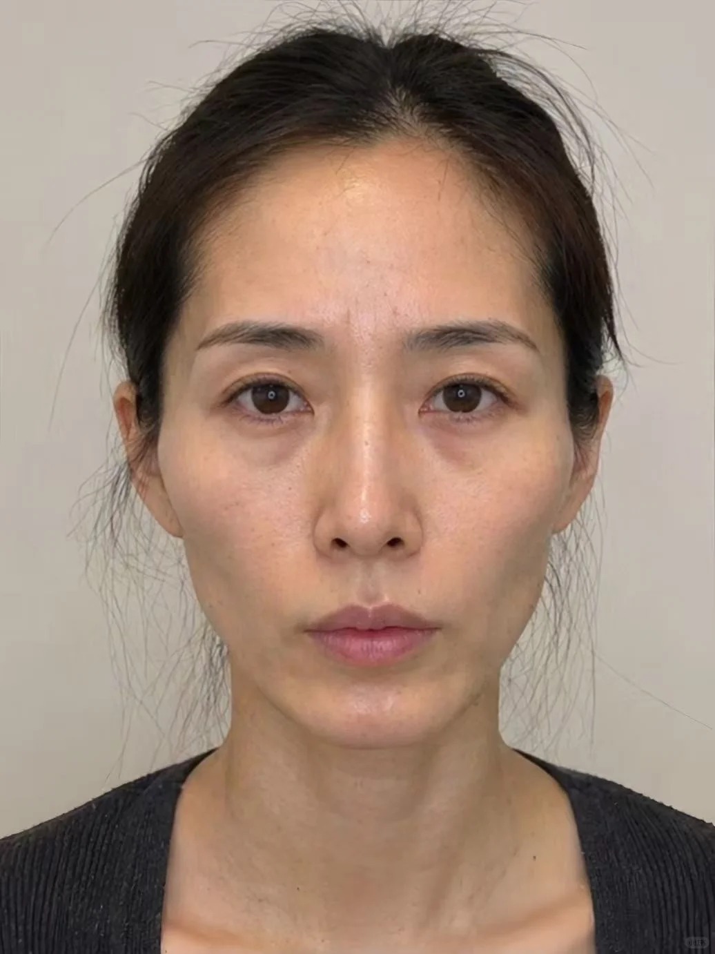 改善垮脸老态疲惫
