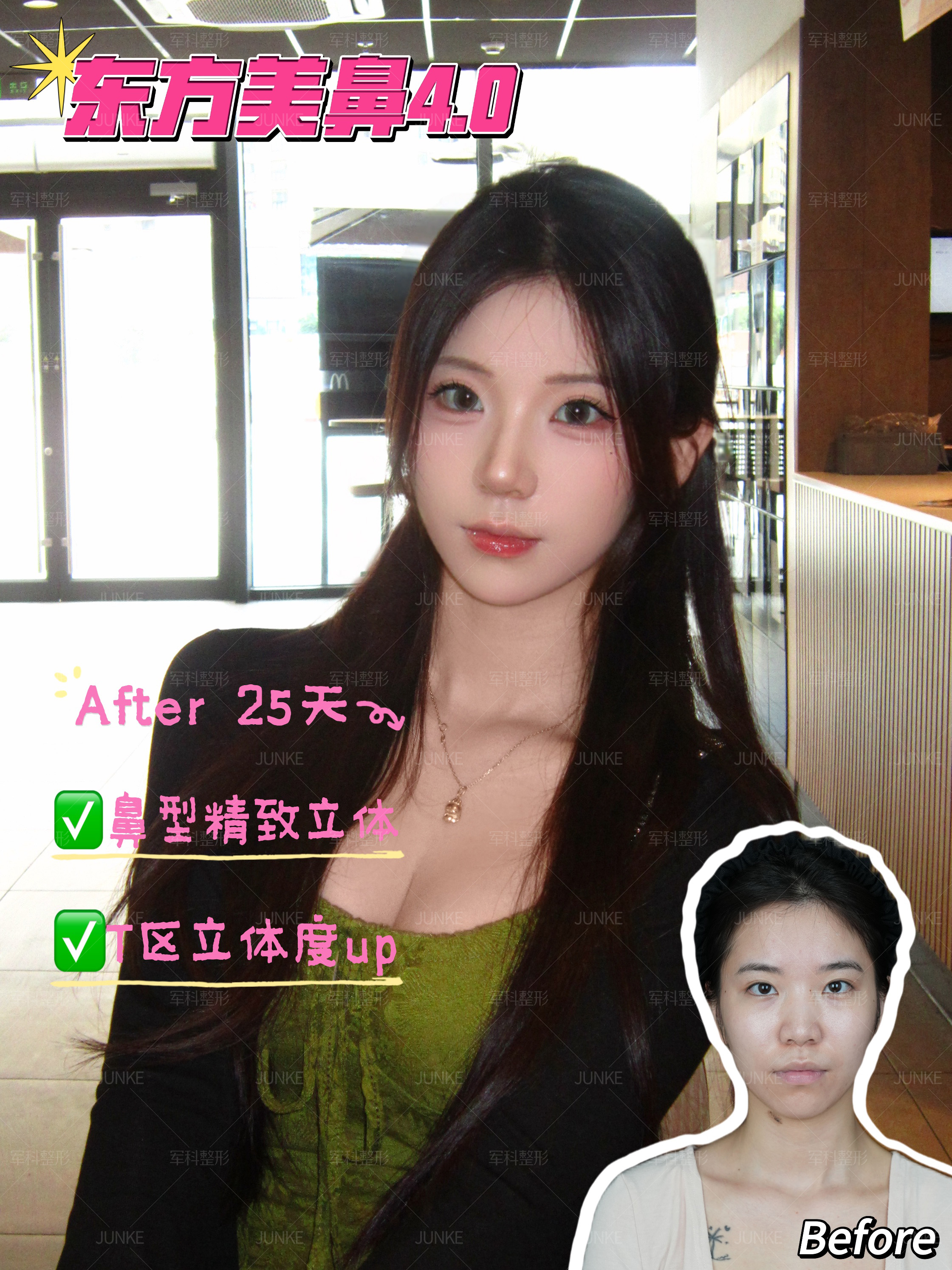 鼻型微调，颜值升级📈 1