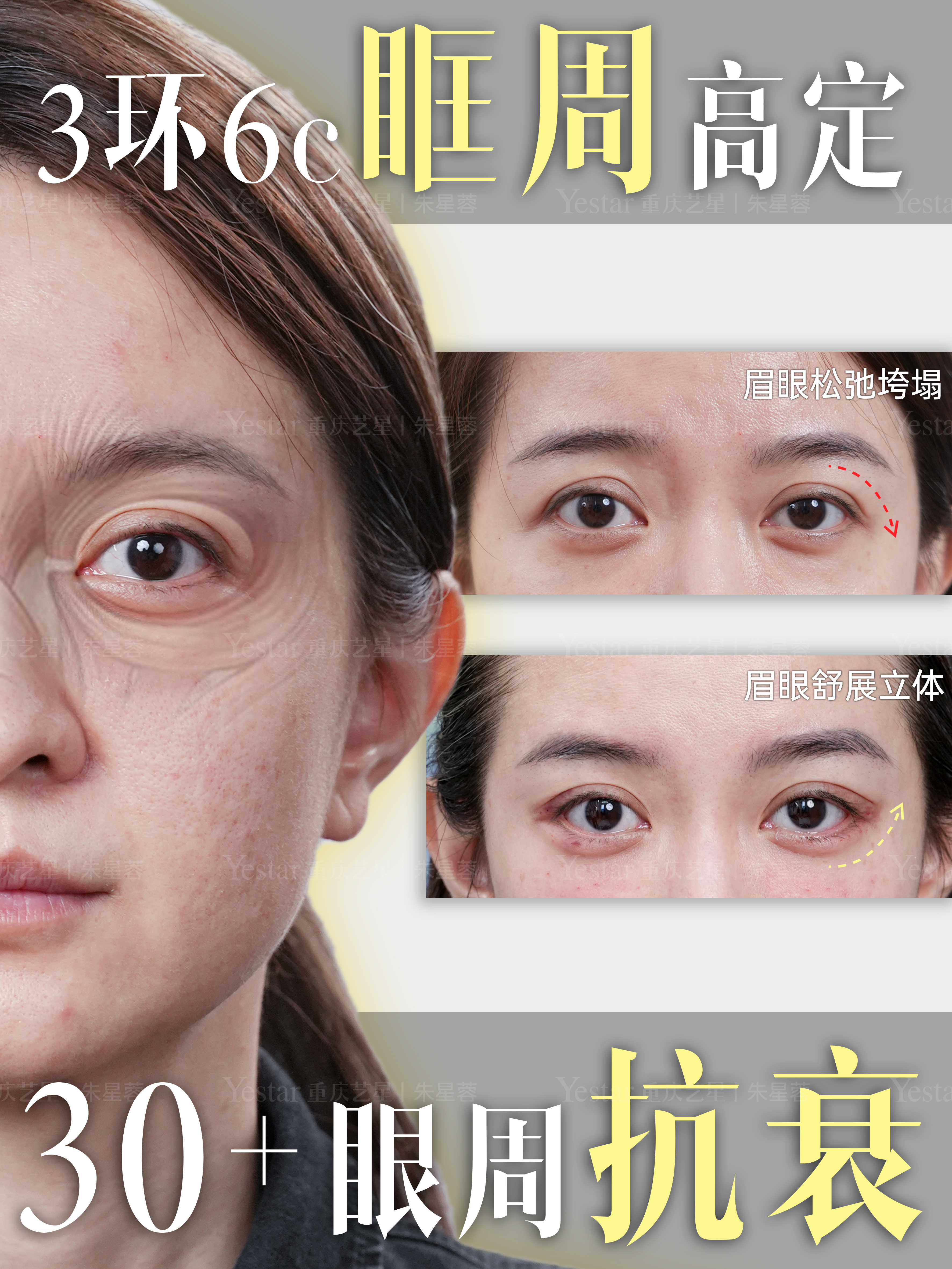 眼周抗衰✨ 1