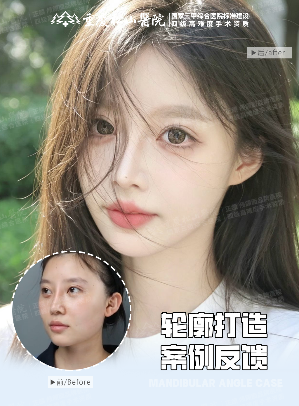 轮廓打造真实案例反馈~ 1