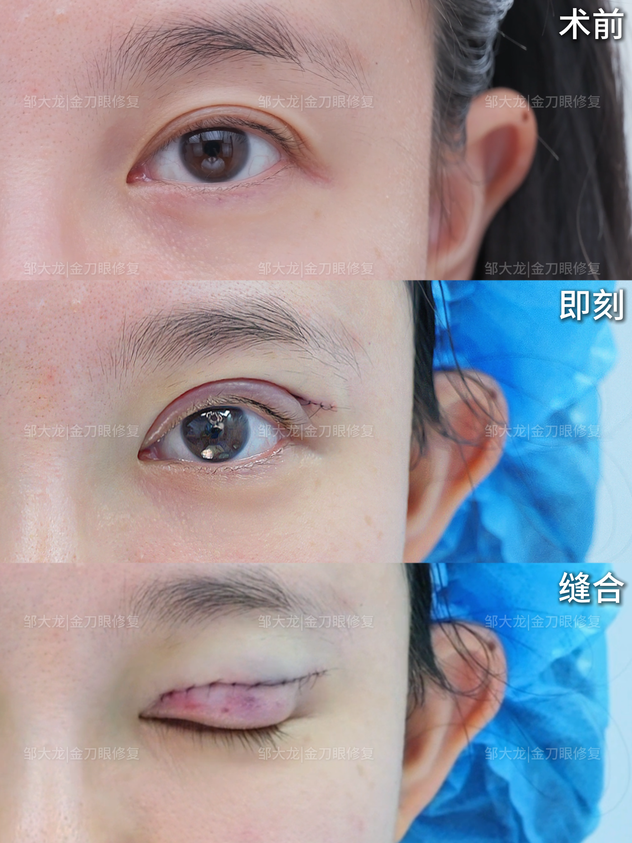 阿尔法定制美眼 2