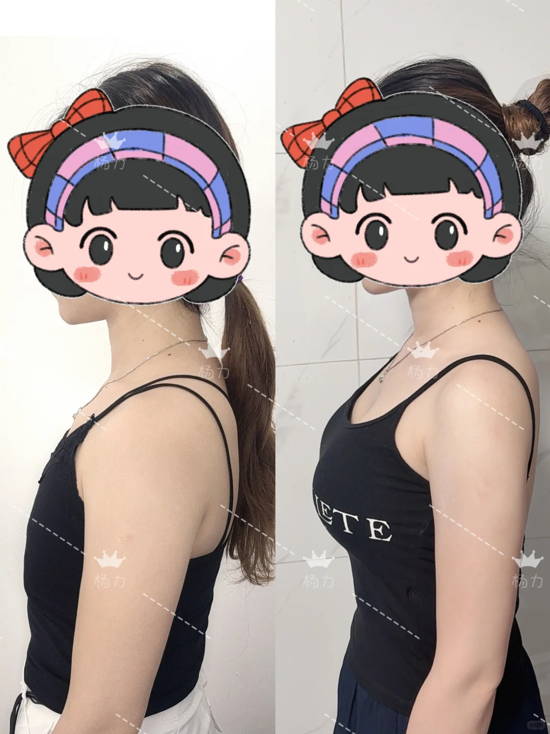 30天前vs30天后😍