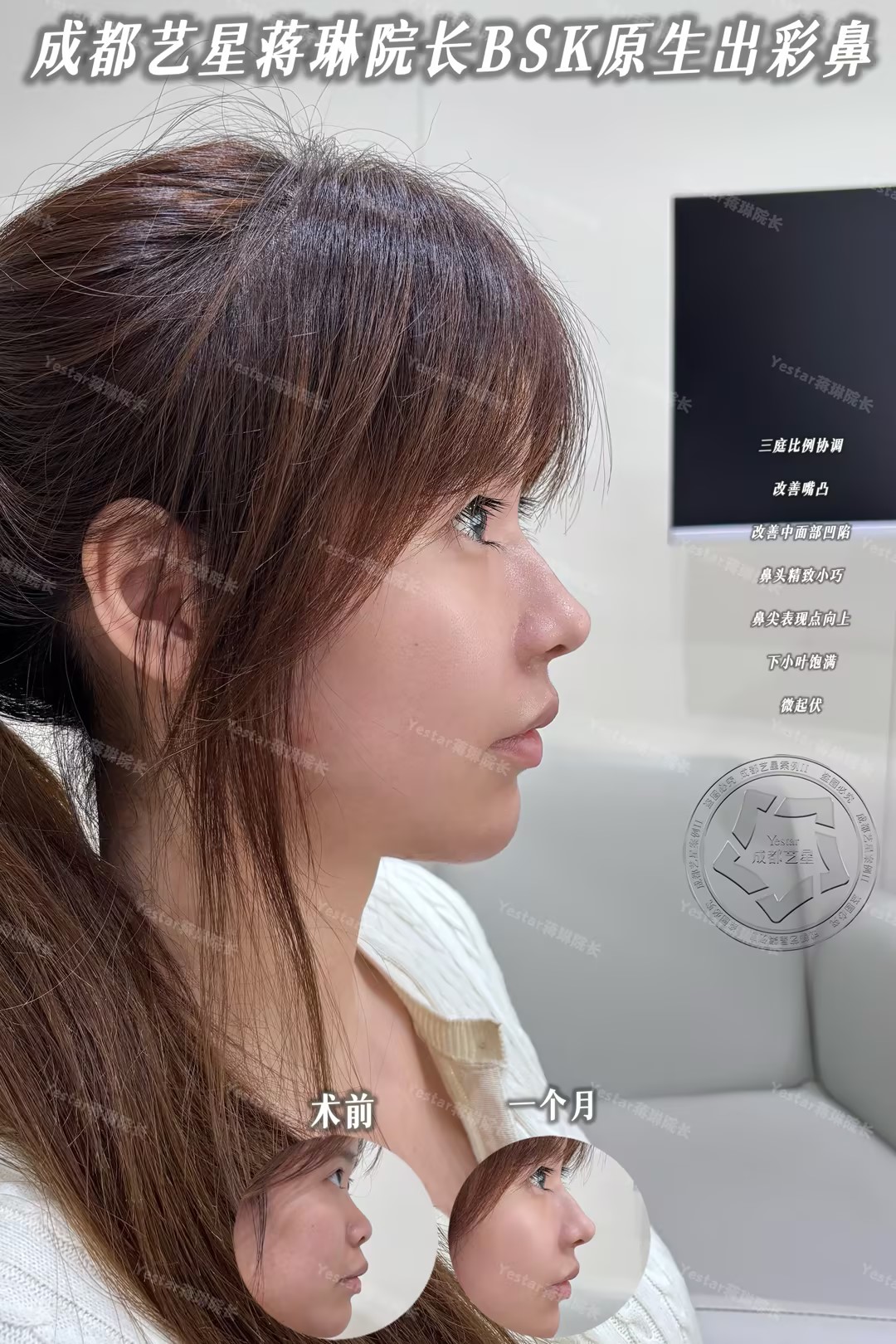 微调鼻型，协调三庭 3