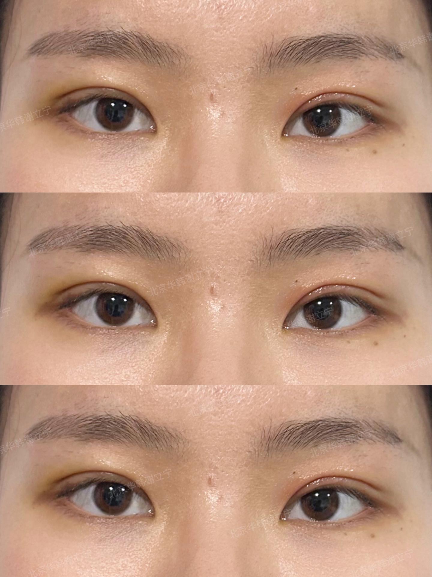 好看的眼睛一眼吸引～ 1